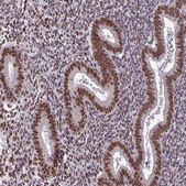 Anti-TTF1 antibody produced in rabbit Prestige Antibodies&#174; Powered by Atlas Antibodies, affinity isolated antibody, buffered aqueous glycerol solution