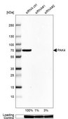 Anti-PAK4 antibody produced in rabbit Prestige Antibodies&#174; Powered by Atlas Antibodies, affinity isolated antibody