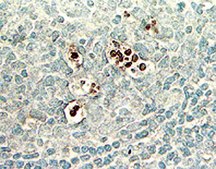 ApopTag Peroxidase In Situ Apoptosis Detection Kit The ApopTag Peroxidase In Situ Apoptosis Detection Kit detects apoptotic cells in situ by labeling &amp; detecting DNA strand breaks by the TUNEL method.