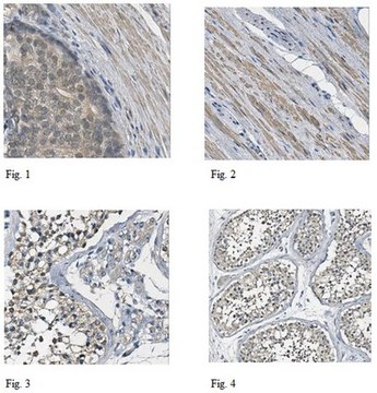 Anti-Death-associated protein 1 Antibody 1.0&#160;mg/mL, from rabbit