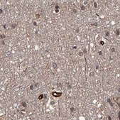 Anti-RPAP3 antibody produced in rabbit Prestige Antibodies&#174; Powered by Atlas Antibodies, affinity isolated antibody, buffered aqueous glycerol solution