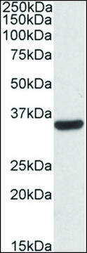 Anti-CNN2 antibody produced in goat affinity isolated antibody, buffered aqueous solution