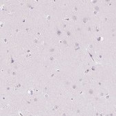 Anti-SLC5A2 antibody produced in rabbit Prestige Antibodies&#174; Powered by Atlas Antibodies, affinity isolated antibody, buffered aqueous glycerol solution