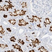 Anti-SLC22A13 antibody produced in rabbit Prestige Antibodies&#174; Powered by Atlas Antibodies, affinity isolated antibody, buffered aqueous glycerol solution