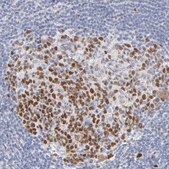 Anti-MCM7 antibody produced in rabbit Prestige Antibodies&#174; Powered by Atlas Antibodies, affinity isolated antibody, buffered aqueous glycerol solution