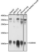 Anti-S100A6 antibody produced in rabbit