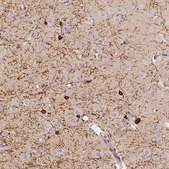 Anti-CNP antibody produced in rabbit Prestige Antibodies&#174; Powered by Atlas Antibodies, affinity isolated antibody, buffered aqueous glycerol solution, Ab2