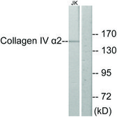 Anti-Collagen IV &#945;2 antibody produced in rabbit affinity isolated antibody