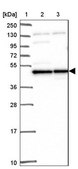 Anti-MAP2K2 antibody produced in rabbit Prestige Antibodies&#174; Powered by Atlas Antibodies, affinity isolated antibody, buffered aqueous glycerol solution