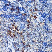 Anti-CSK antibody produced in rabbit