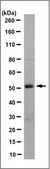 Anti-Wilms&#8242; Tumor Antibody, NT clone 6F-H2, Ascites Free clone 6F-H2, from mouse