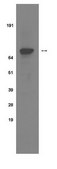 Anti-phospho-Insulin Receptor (Tyr 1322) Antibody, clone 21G12 clone 21g12, Upstate&#174;, from mouse