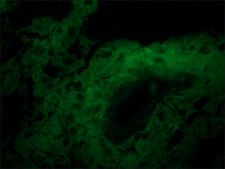 Anti-l-Afadin antibody produced in rabbit affinity isolated antibody, buffered aqueous solution