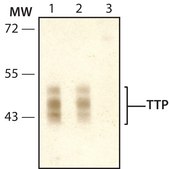 Anti-TTP (N-terminal) antibody produced in rabbit ~1.0&#160;mg/mL, affinity isolated antibody, buffered aqueous solution