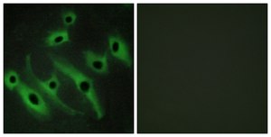 Anti-HER2 antibody produced in rabbit affinity isolated antibody