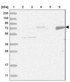 Anti-LIMK1 antibody produced in rabbit Prestige Antibodies&#174; Powered by Atlas Antibodies, affinity isolated antibody, buffered aqueous glycerol solution, ab1