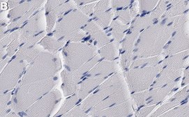 Anti-SLC16A3/MCT4 Antibody, clone 2J22 ZooMAb&#174; Rabbit Monoclonal recombinant, expressed in HEK 293 cells