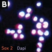 Neural Stem Cell Marker Characterization Kit The Neural Stem Cell Characterization Kit contains two molecular markers, Nestin &amp; Sox 2 that are frequently used to identify neural stem/progenitor cells.
