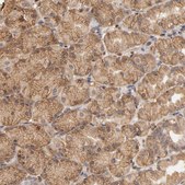 Anti-PKN1 antibody produced in rabbit Prestige Antibodies&#174; Powered by Atlas Antibodies, affinity isolated antibody, buffered aqueous glycerol solution