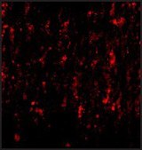 Anti-SATB2 (ab1) antibody produced in rabbit affinity isolated antibody, buffered aqueous solution