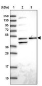 Anti-ACTR3 antibody produced in rabbit Prestige Antibodies&#174; Powered by Atlas Antibodies, affinity isolated antibody, buffered aqueous glycerol solution