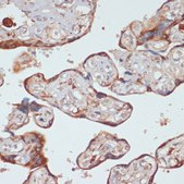 Anti-Caspase 9 antibody produced in rabbit