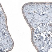 Anti-FGFR2 antibody produced in rabbit Prestige Antibodies&#174; Powered by Atlas Antibodies, affinity isolated antibody, buffered aqueous glycerol solution