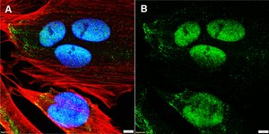 Anti-CDK9 Antibody, clone 1F9 ZooMAb® Rabbit Monoclonal recombinant, expressed in HEK 293 cells
