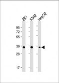 [KO Validated]Anti-LIN28B antibody produced in mouse [Knockout Validated]purified monoclonal antibody, buffered aqueous solution
