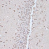 Anti-Phospho-PRKAA1-T183/PRKAA2-T172 antibody produced in rabbit