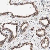 Anti-GOLGB1 antibody produced in rabbit Ab1, Prestige Antibodies&#174; Powered by Atlas Antibodies, affinity isolated antibody, buffered aqueous glycerol solution