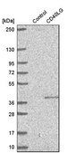 Anti-CD40LG antibody produced in rabbit Prestige Antibodies&#174; Powered by Atlas Antibodies, affinity isolated antibody, buffered aqueous glycerol solution