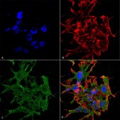 Monoclonal Anti-Cav3.1 - Rpe antibody produced in mouse clone S178A-9, purified immunoglobulin