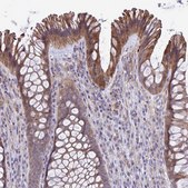 Anti-KCNMA1 antibody produced in rabbit Prestige Antibodies&#174; Powered by Atlas Antibodies, affinity isolated antibody, buffered aqueous glycerol solution