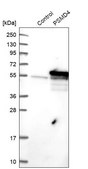 Anti-PSMD4 antibody produced in rabbit Prestige Antibodies&#174; Powered by Atlas Antibodies, affinity isolated antibody, buffered aqueous glycerol solution