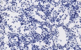 Anti-AFP Antibody, clone 3B7 ZooMAb® Rabbit Monoclonal recombinant, expressed in HEK 293 cells