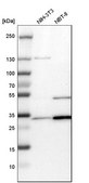 Anti-TPM3 antibody produced in rabbit Prestige Antibodies&#174; Powered by Atlas Antibodies, affinity isolated antibody, buffered aqueous glycerol solution