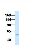 Anti-ABCC3 affinity isolated antibody