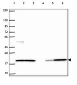 Anti-CFL1 antibody produced in rabbit Prestige Antibodies&#174; Powered by Atlas Antibodies, affinity isolated antibody, buffered aqueous glycerol solution