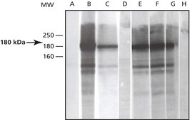 Anti-Phosphotyrosine antibody produced in rabbit 0.5&#160;mg/mL, affinity isolated antibody, buffered aqueous solution