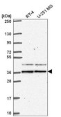 Anti-SPRY1 antibody produced in rabbit Prestige Antibodies&#174; Powered by Atlas Antibodies, affinity isolated antibody