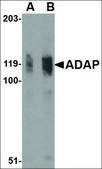 Anti-ADAP (ab2) antibody produced in rabbit affinity isolated antibody, buffered aqueous solution