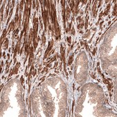 Anti-CACNA1H antibody produced in rabbit Prestige Antibodies&#174; Powered by Atlas Antibodies, affinity isolated antibody, buffered aqueous glycerol solution