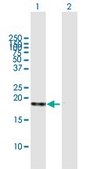 Anti-SOD1 antibody produced in mouse purified immunoglobulin, buffered aqueous solution