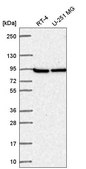 Anti-PFKP antibody produced in rabbit Prestige Antibodies&#174; Powered by Atlas Antibodies, affinity isolated antibody