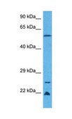 Anti-RORC (AB2) antibody produced in rabbit affinity isolated antibody