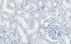 Anti-Cdc42 Antibody, clone 2D16 ZooMAb&#174; Rabbit Monoclonal recombinant, expressed in HEK 293 cells