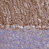 Anti-AQP4 antibody produced in rabbit affinity isolated antibody, Prestige Antibodies&#174; Powered by Atlas Antibodies, buffered aqueous glycerol solution