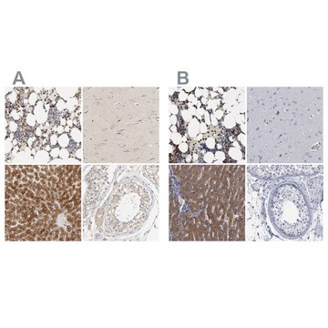 Anti-PYGL antibody produced in rabbit Prestige Antibodies&#174; Powered by Atlas Antibodies, affinity isolated antibody, buffered aqueous glycerol solution
