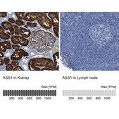 Anti-ASS1 antibody produced in rabbit Prestige Antibodies&#174; Powered by Atlas Antibodies, affinity isolated antibody, buffered aqueous glycerol solution, Ab1